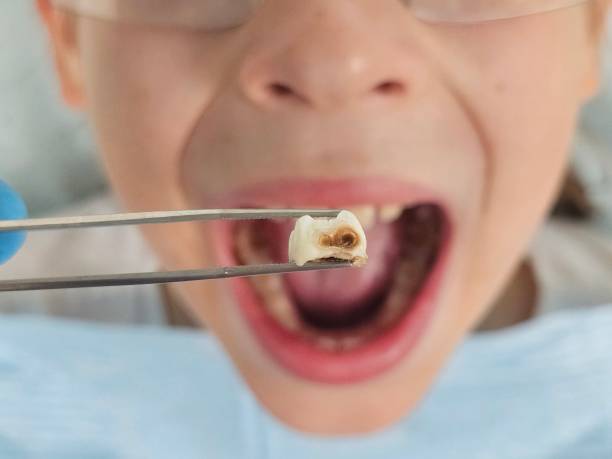 Best Pediatric Emergency Dentist in Mechanicville, NY